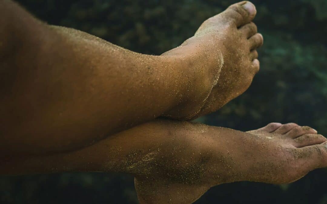 Piedi maleodoranti: ecco i rimedi!