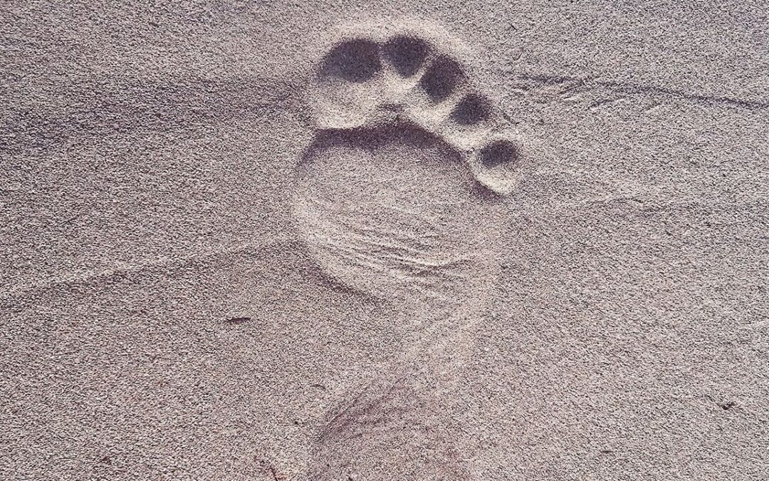 Micosi unghie piedi: prevenzione e cura