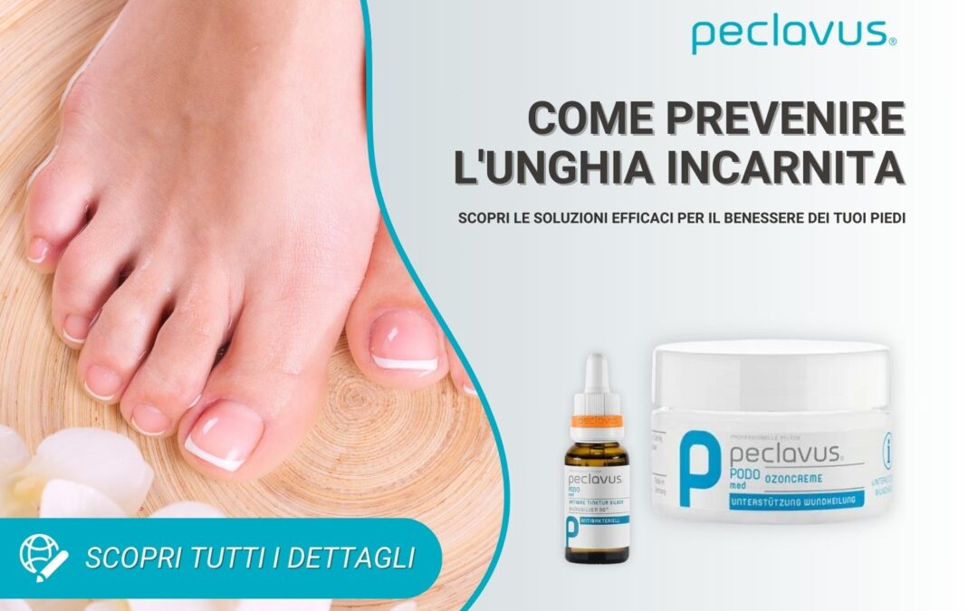 Prevenire l’Unghia Incarnita: Consigli e Soluzioni Efficaci
